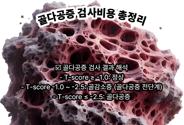 골다공증 검사비용 총정리