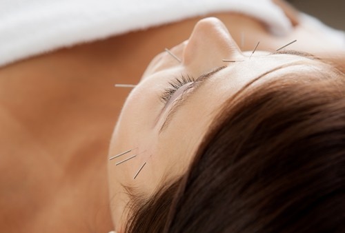 침 치료