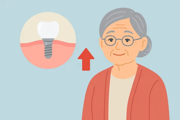 임플란트 건강보험 적용 대상 안내