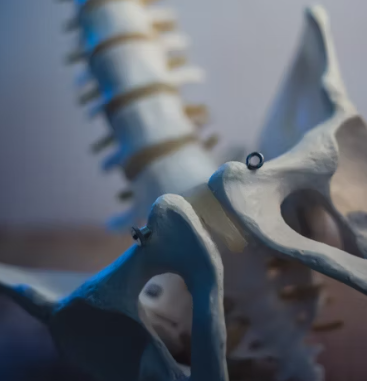 골다공증에 좋은 음식 예방 식단