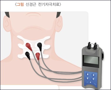 삼킴 반사 촉진을 위한 신경근 전기자극 치료