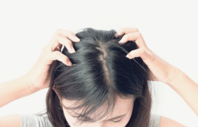 머리가 가려운 이유