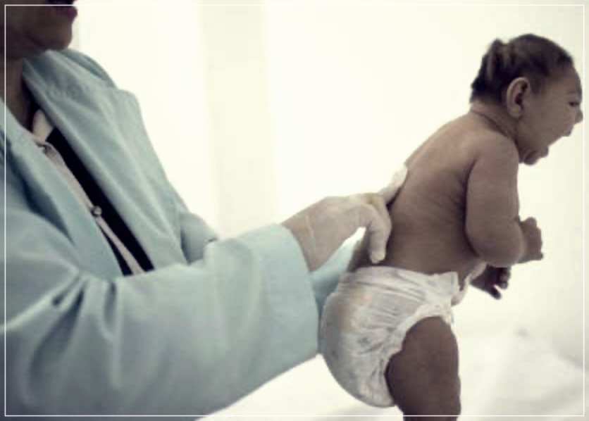 소두증 이란? 원인, 증상, 치료방법들