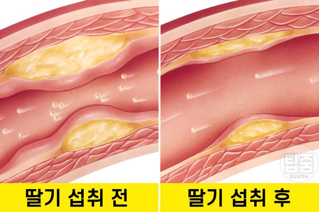 딸기 효능,장내 미생물 다이어트,콜레스테롤 낮추는 음식