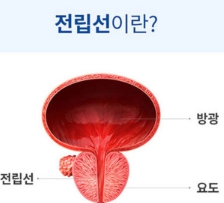 전립선비대증 치료와 좋은음식 총정리