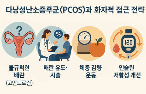 다낭성난소증후군(PCOS)과 난임: 효과적 접근 전략