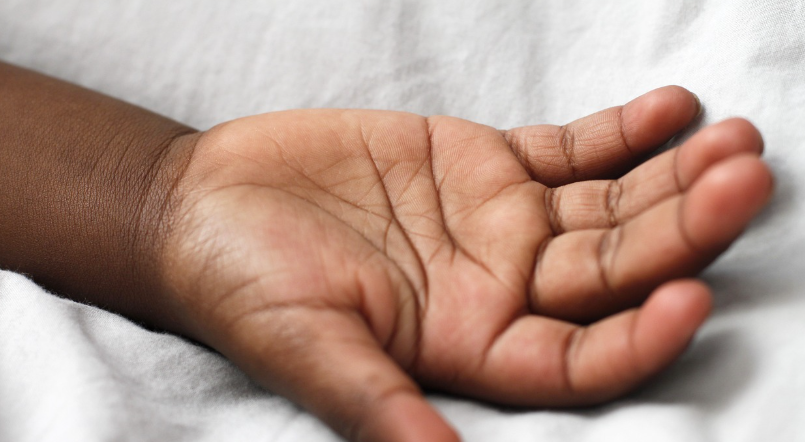 부종 감소를 위한 방법