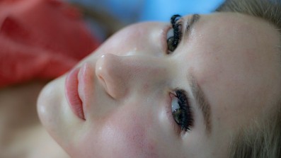 여드름 흉터 자국