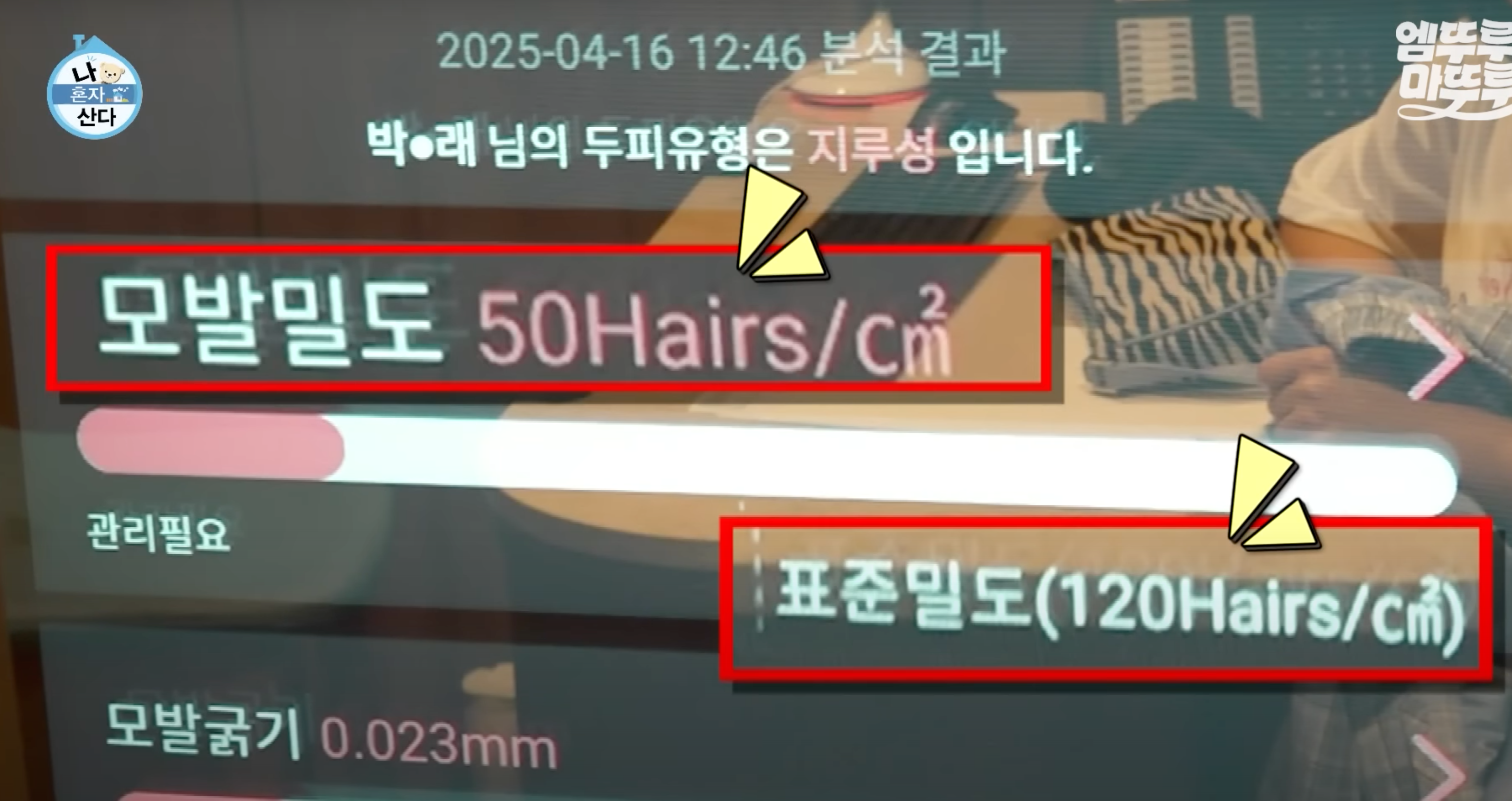 박나래탈모 나혼자산다 MBC