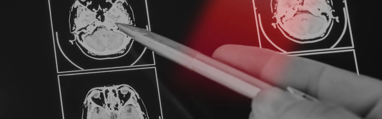 상장일정 및 보호예수 물량