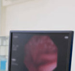 신경성 위염 증상 원인 치료 