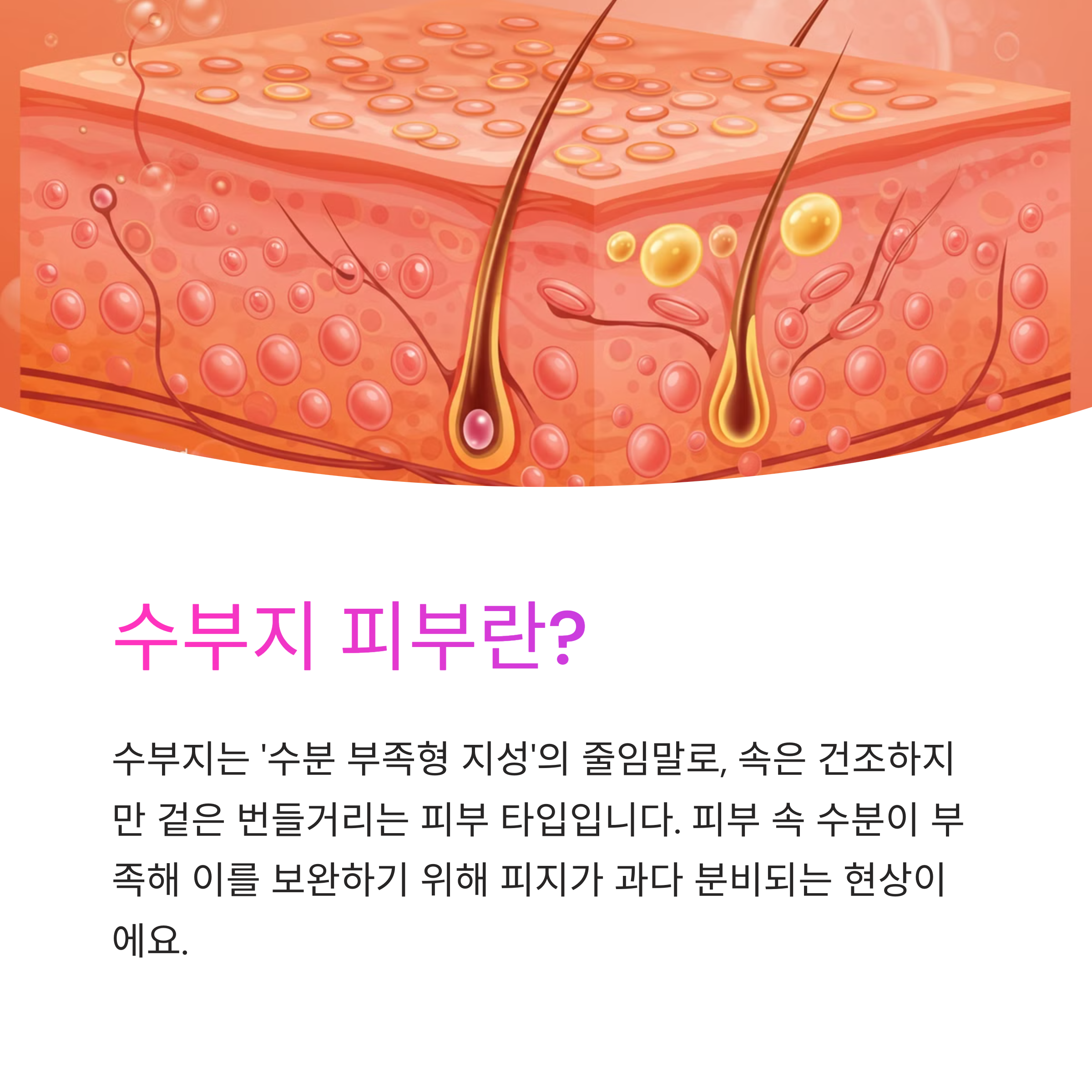 수부지 피부를 위한 스킨케어, 보습과 피지 조절 동시에 해결하기