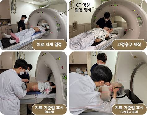 방사선치료