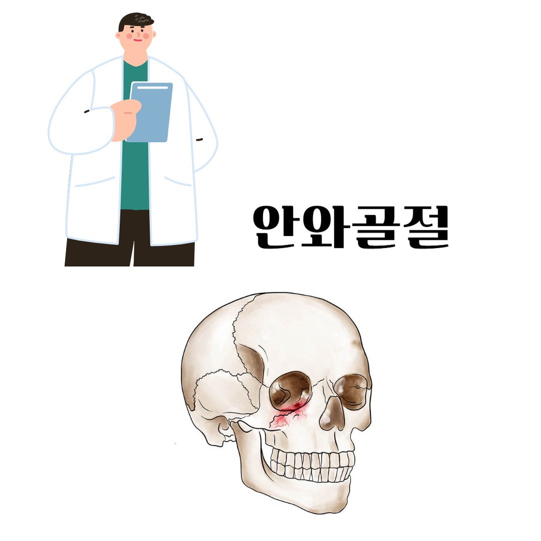 안와골절