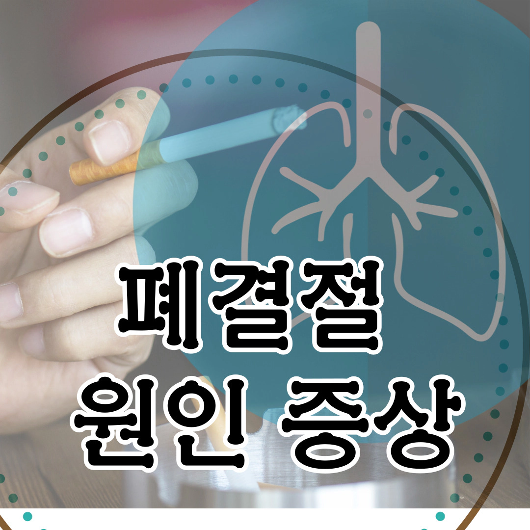 폐결절&nbsp;원인-증상