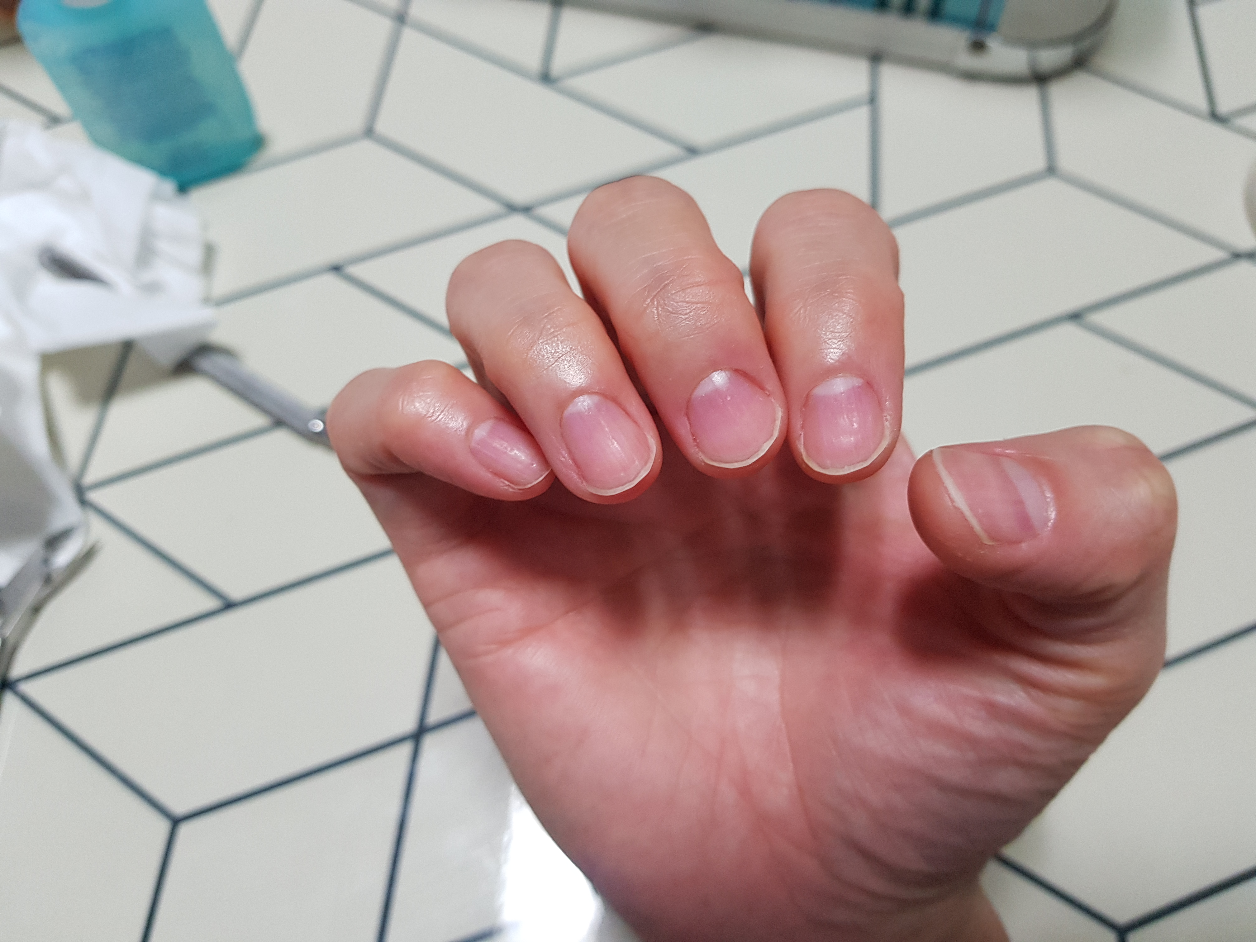 큐티클 제거 후