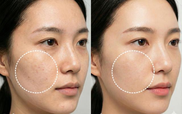 아스파라거스 효능 피부노화 항산화