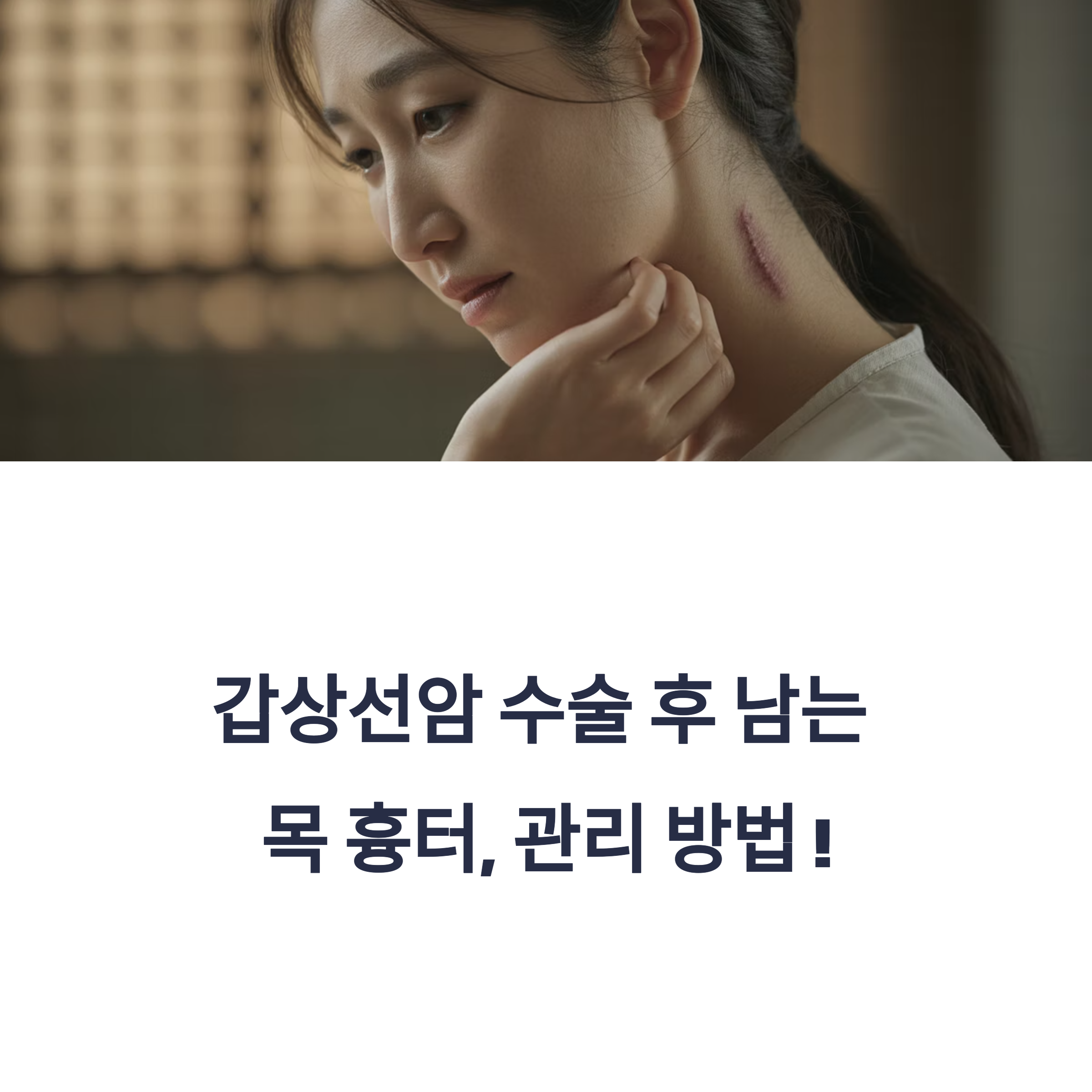 갑상선암 수술 흉터