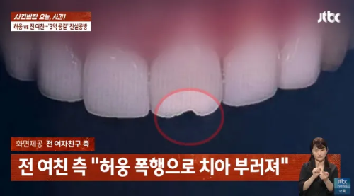 허웅의 전여친 측 "허웅 폭행으로 치아 부러져" 출처: jtbc 사건반장