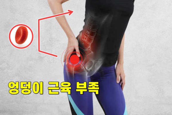 혈압이 갑자기 높아지는 이유, 엉덩이 근육, 혈압 낮추는 법