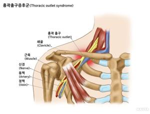 새끼 손가락 저림