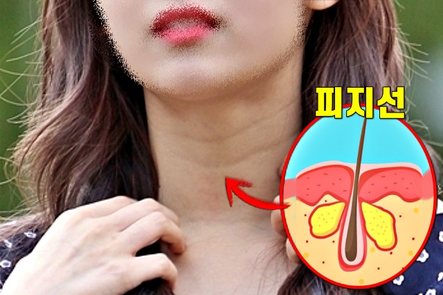 목주름 없애는 운동,스트레칭,건강