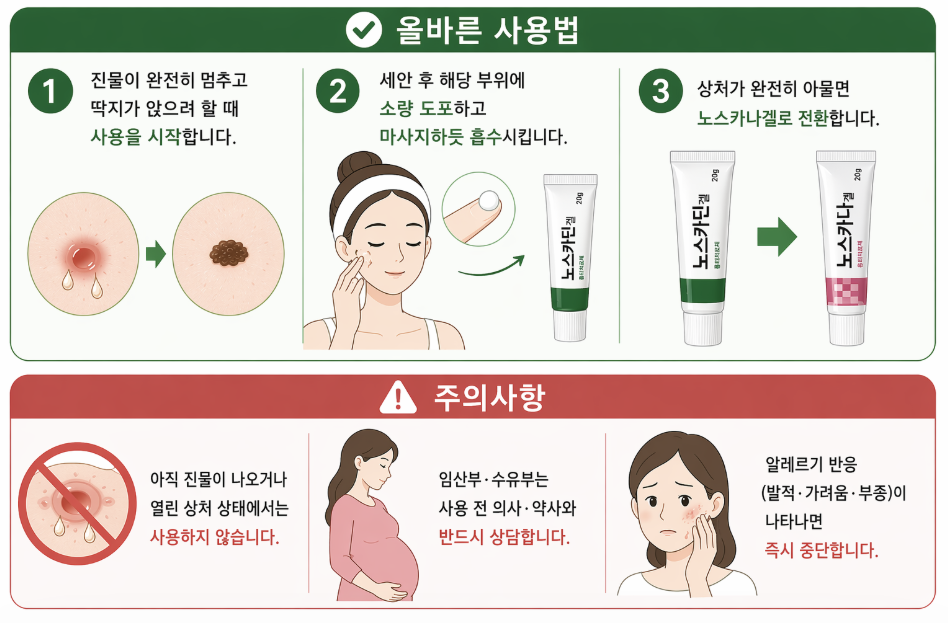 노스카딘겔 사용법 인포그래픽으로 여드름 압출 후 딱지 형성 단계에서 연고 바르는 방법과 상처 회복 후 노스카나겔 전환, 임산부 사용 주의 및 알레르기 반응 주의사항을 정리한 이미지