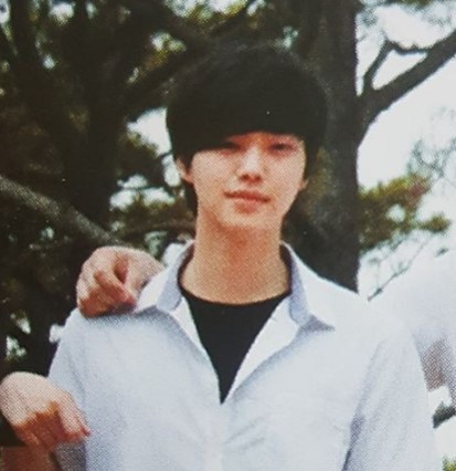 송강 코성형