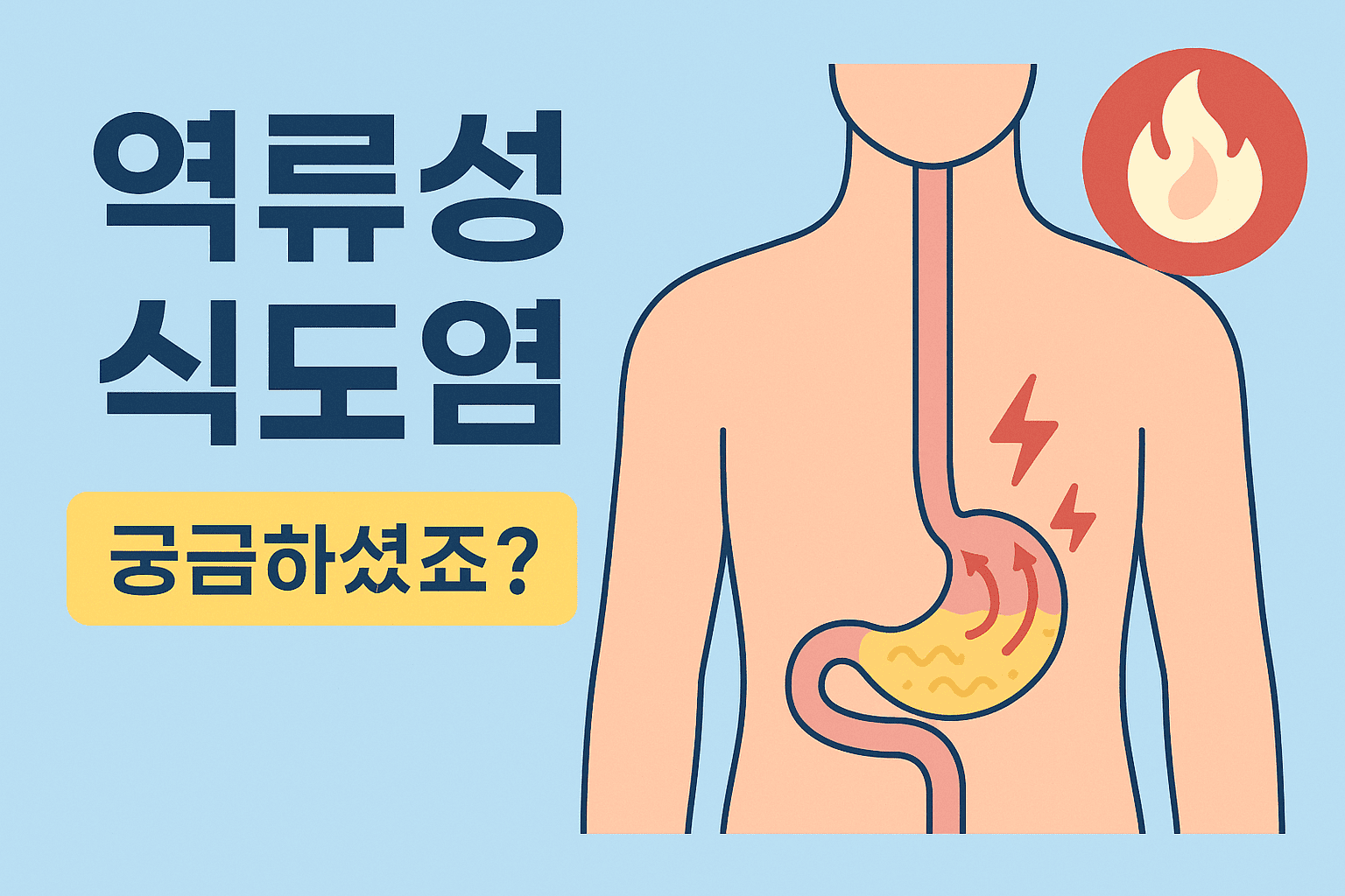 역류성 식도염 증상