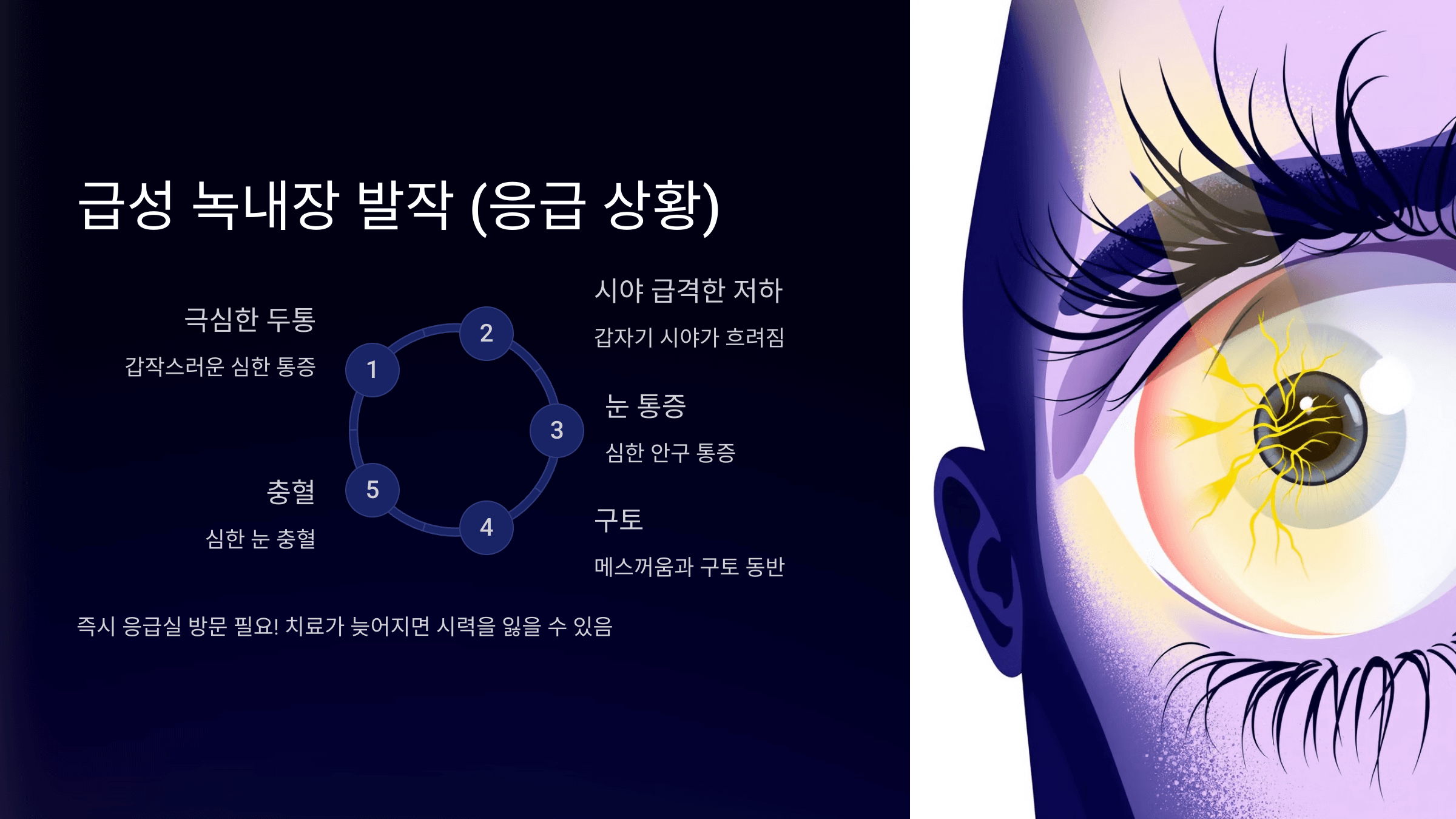 녹내장과 관련된 사진입니다.