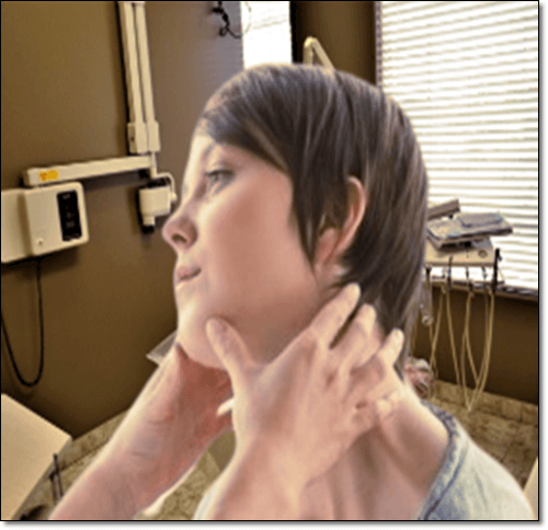 침샘비대증 증상이 있는 여성