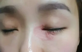 고양이 털 알레르기 완화 방법과 생활 관리 팁_24