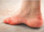 발바닥통증의 원인