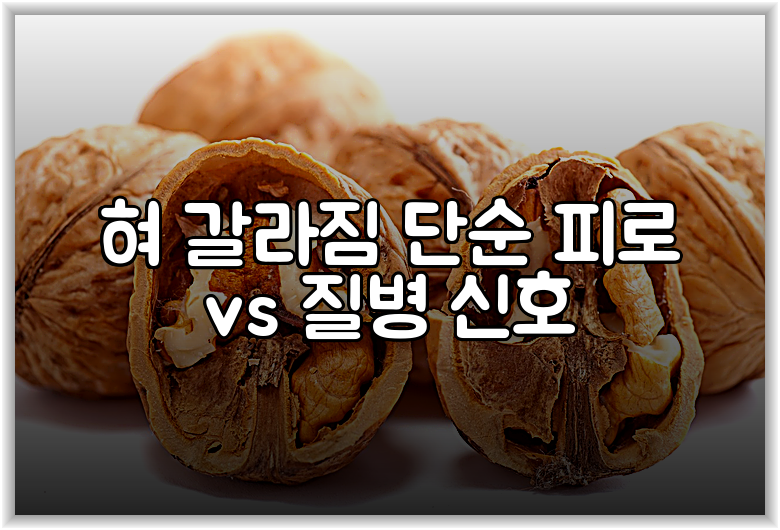 혀 갈라짐 단순 피로 vs 질병 신호