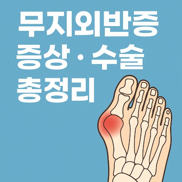 무지 외반증 증상 수술 총정리 문구이미지