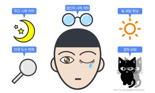 백내장 증상과 안과 병원 추천