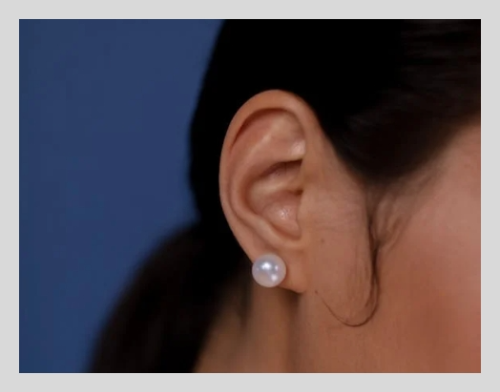 귀이명 증상과 관리에 좋은 영양제 총정리