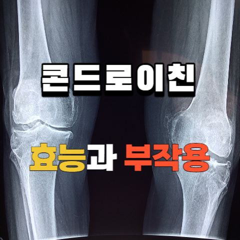 콘드로이친효능과부작용