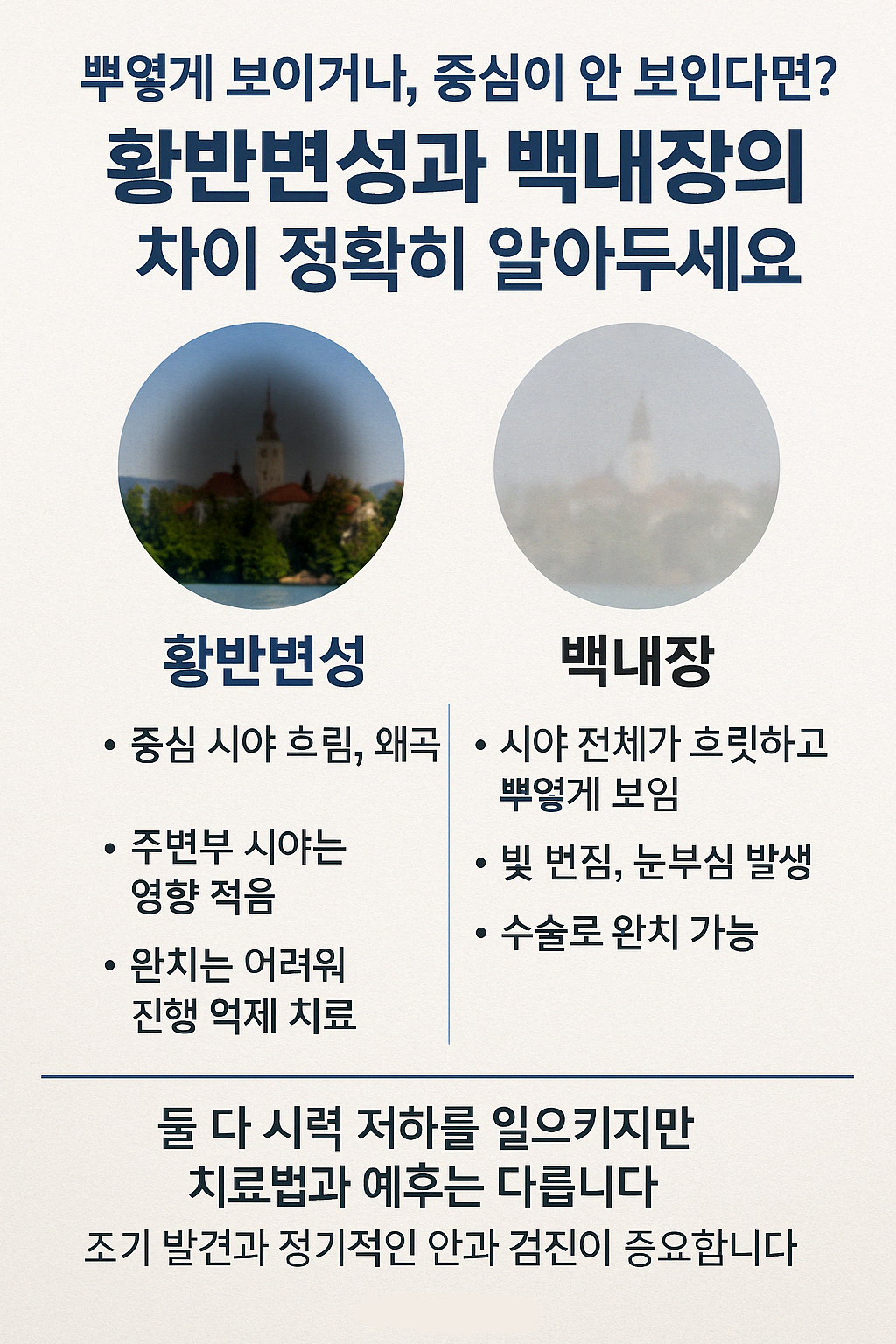 황반변성과 백내장의 시야 차이와 주요 증상을 비교한 인포그래픽 이미지