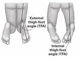 thigh-foot angle