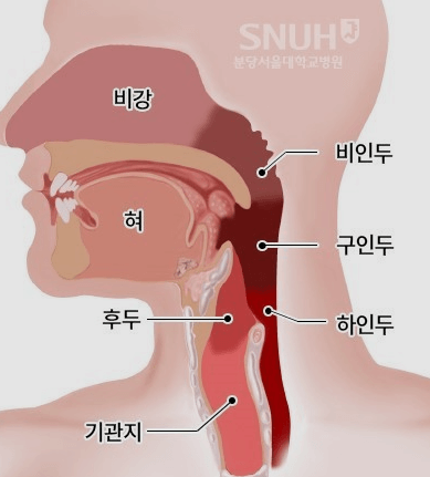 편도암 초기증상 생존율