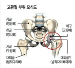 고관절 모식도