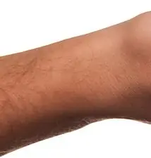 베트남 여행자보험 필수 보장 항목 5가지, 청구 방법