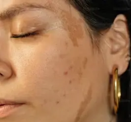 고혼진 기미크림 내돈내산