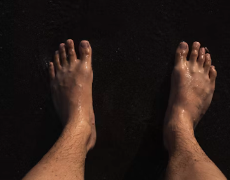 무좀 증상 치료법 원인 발톱 손톱