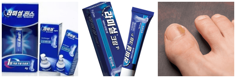 라미실원스, 라미실크림, 발톱무좀 사진