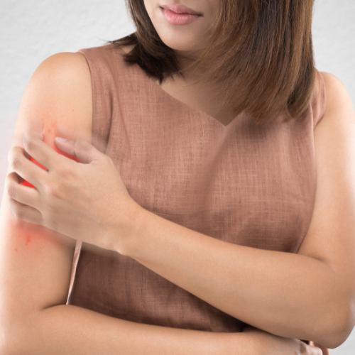 접촉성피부염증상 이게 시작이라니 피부염원인부터 관리법까지