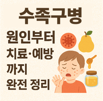 수족구병 – 원인부터 치료·예방까지 완전 정리