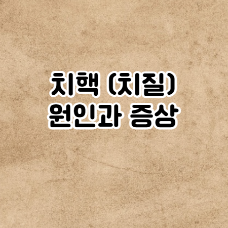 치핵(치질)의 증상 (자연치유, 예방방법, 발생원인)