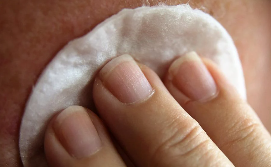 피부에 난 낭종은 짜지 말고, 온찜질과 냉찜질을 병행해 고통을 완화하고 진정시키는 것이 좋습니다.